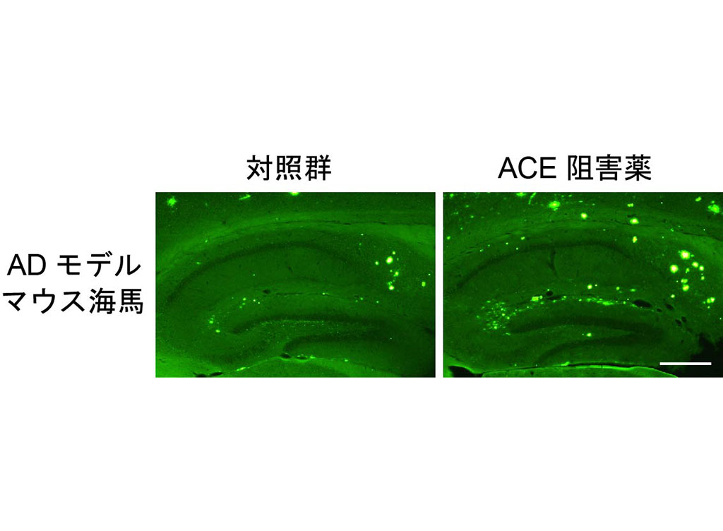 アルツハイマー病発症機構におけるアミロイド蓄積およびAβ代謝（産生・分解）制御メカニズムの解明